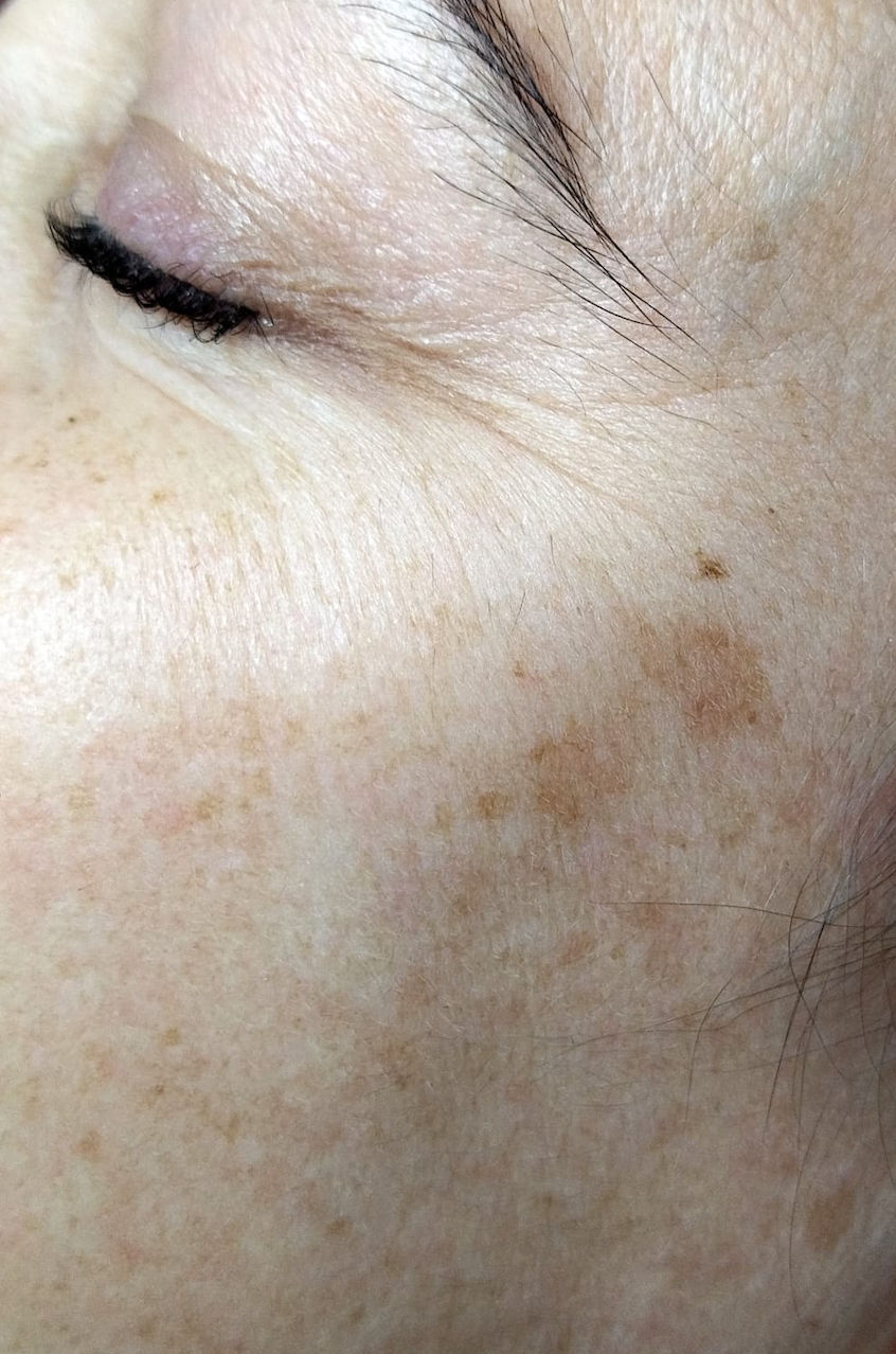 Ana Moreira Estética - Póvoa de Santa Iria - Image 12