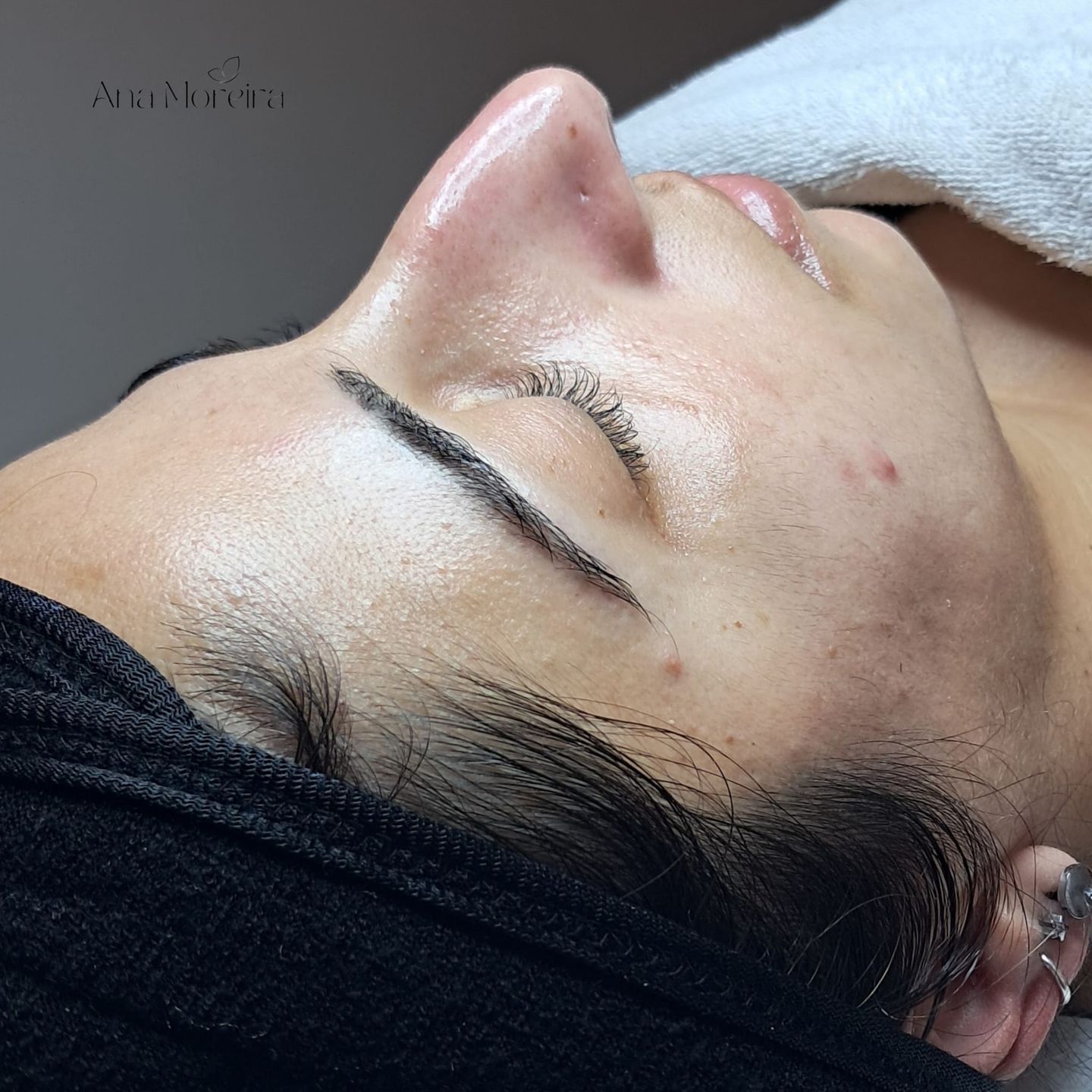 Ana Moreira Estética - Alverca - Image 2
