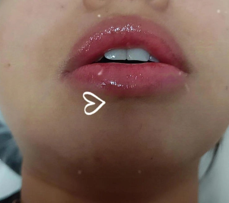 Zeni Alves Estética - Image 23