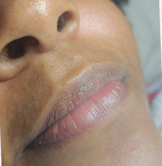 Zeni Alves Estética - Image 29