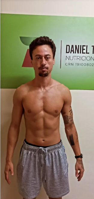 Nutricionista | Daniel Targino - Image 5