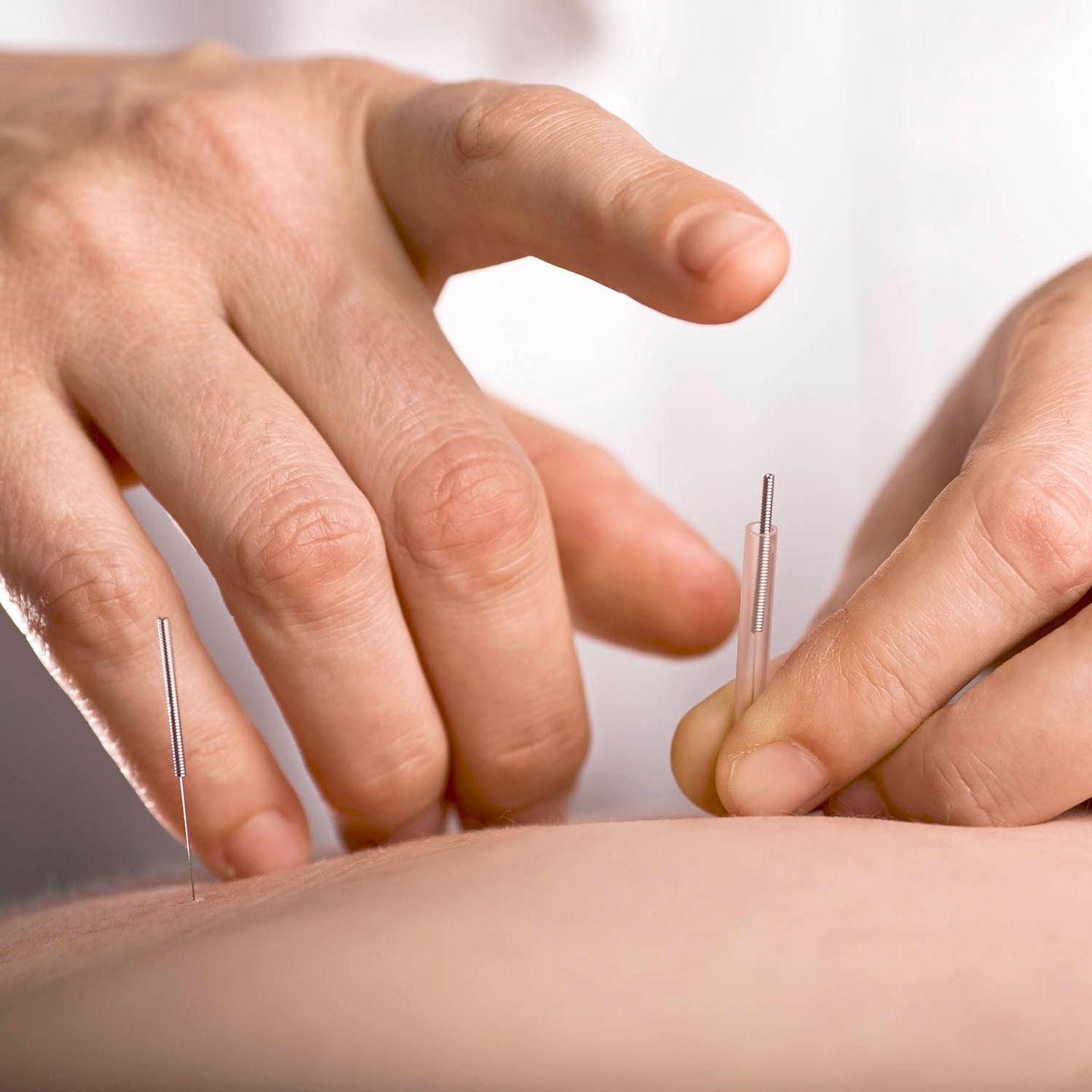 Eduardo Galatoli | Acupuntura e Massoterapia - Image 4
