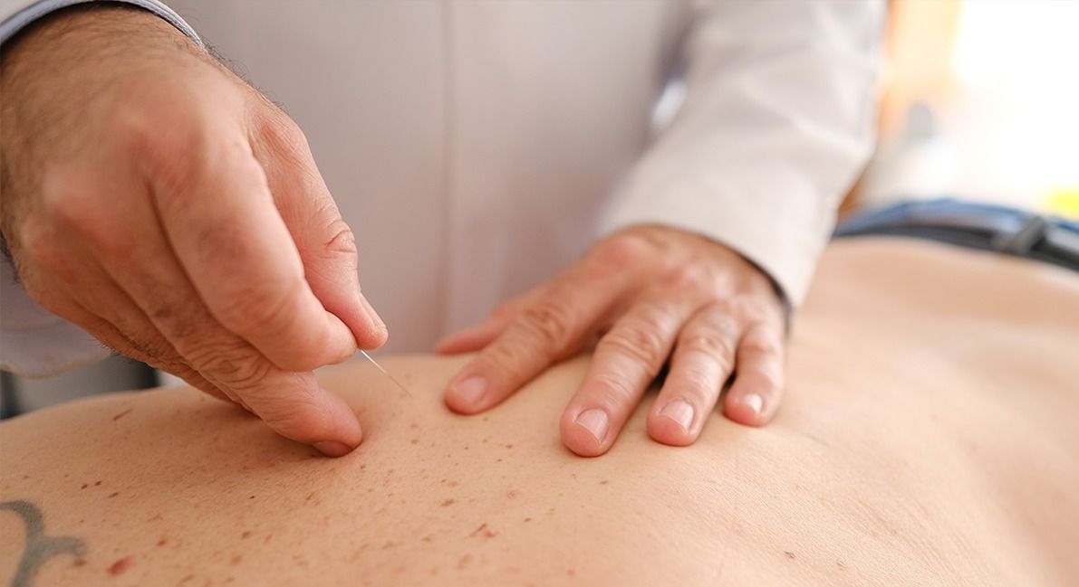 Osires Gianetti | Acupunturista Especializado em Tratamento Natural para Dor de Cabeça - Image 7