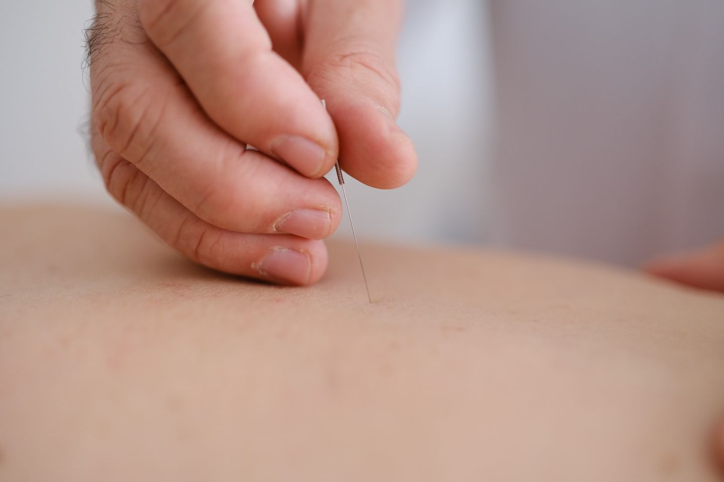 Osires Gianetti | Acupunturista Especializado em Tratamento Natural para Dor de Cabeça - Image 1