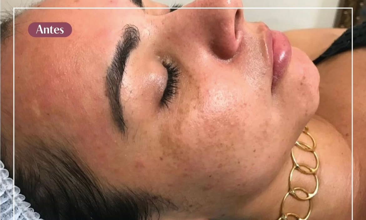 Estética Avançada Dra. Ana Carla Teles - Image 4