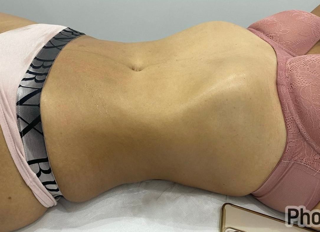 Estética Avançada Dra. Ana Carla Teles - Image 6