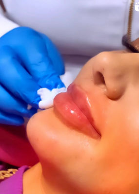 FaceSpa - Image 13
