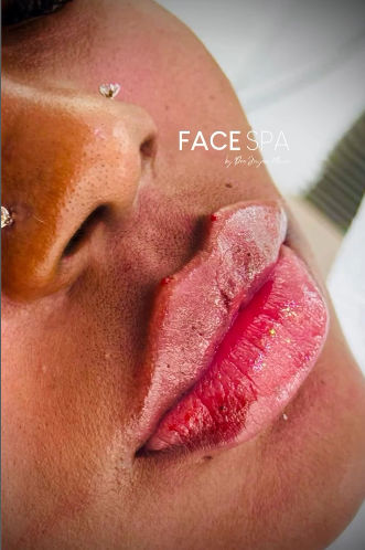 FaceSpa - Image 6