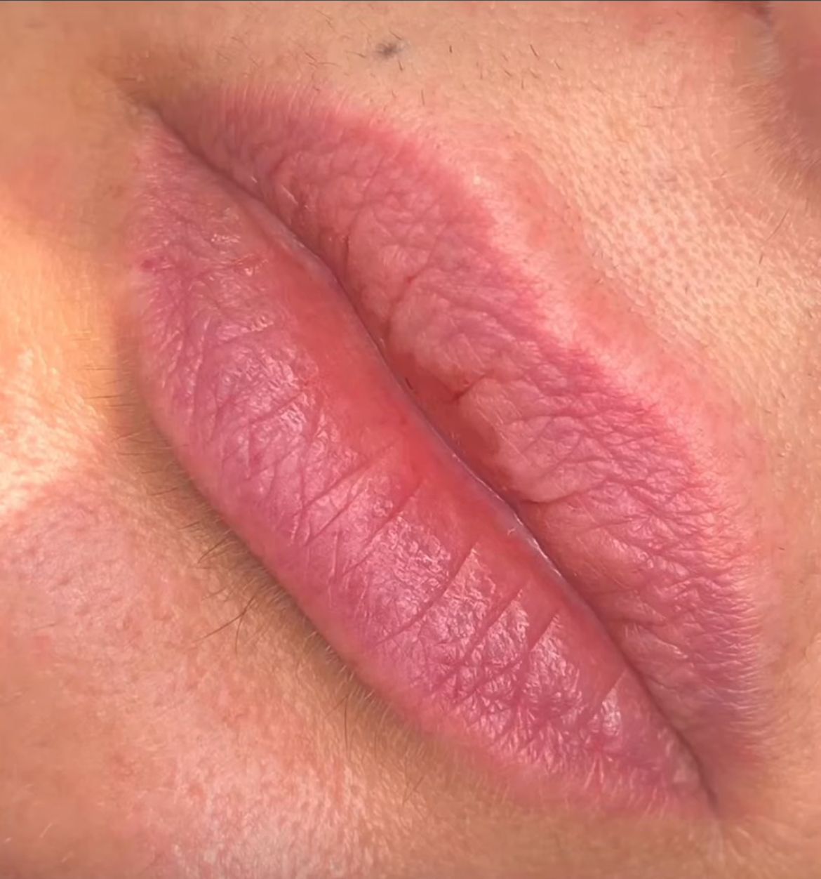 Beauty Reflex - Image 4