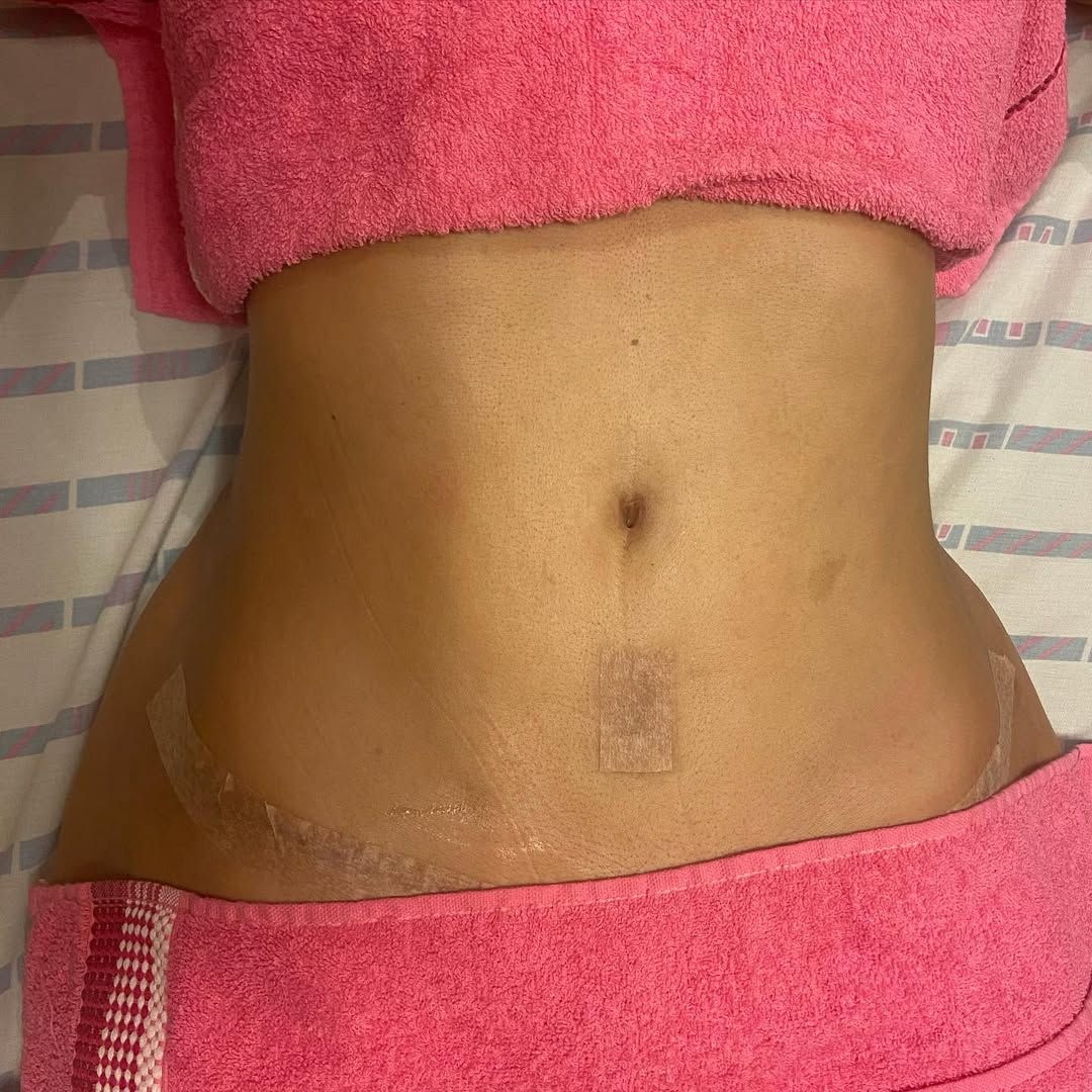 Anne Aguiar Estética - Image 8