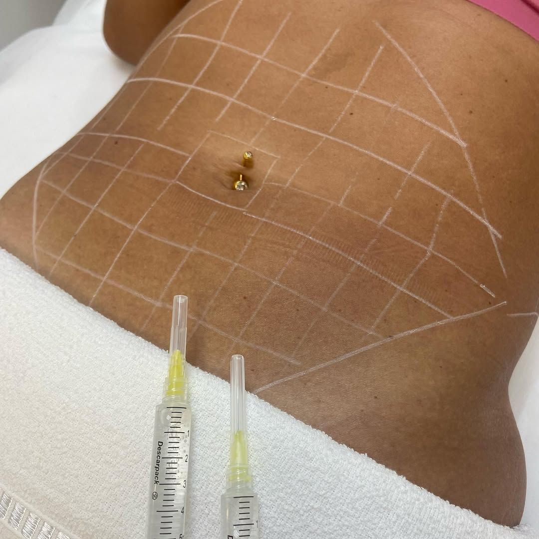 Anne Aguiar Estética - Image 1