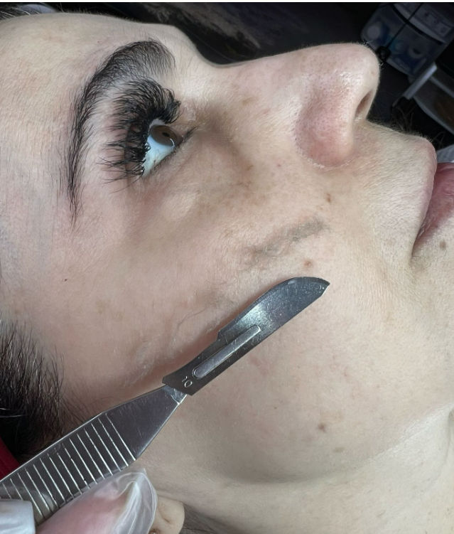 Flaline Spa Beleza Estética - Image 9