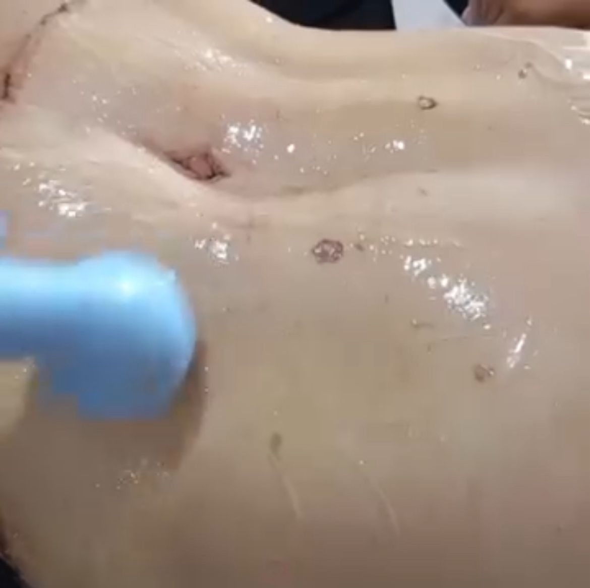 Fany Massoterapeuta e Fisioterapia - Image 5