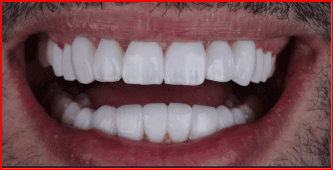 Instituto Carioca de Estética Dental