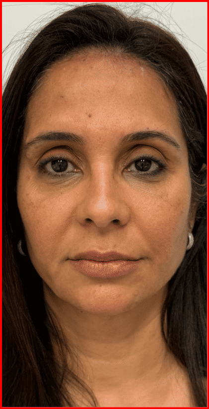 Face Doctor - Image 5