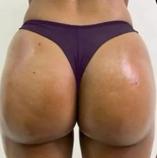 DR Estética & Depilação a Laser - Image 5
