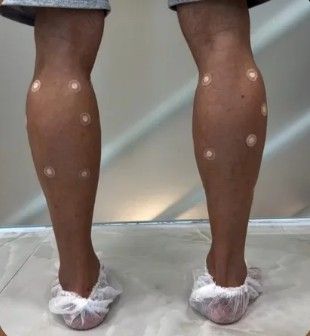 DR Estética & Depilação a Laser - Image 6