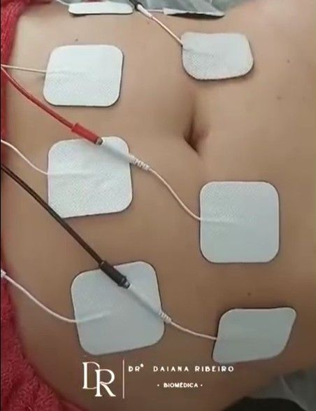DR Estética & Depilação a Laser - Image 2