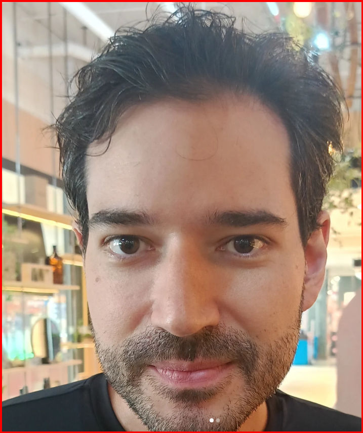 João Siqueira Hair - Image 12