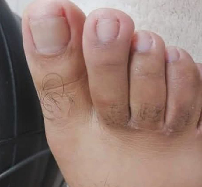 Cleyde Pedicure Medical - Image 2
