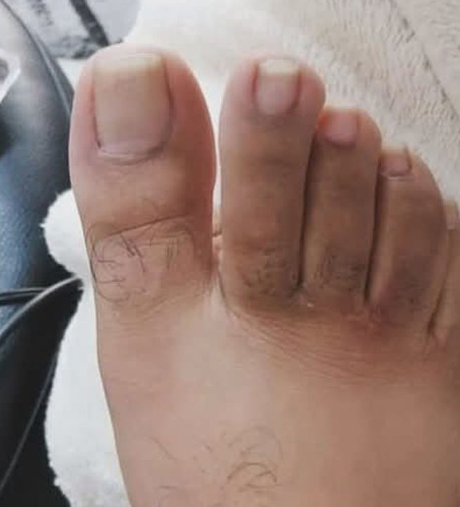 Cleyde Pedicure Medical - Image 4