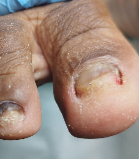 Cleyde Pedicure Medical - Image 7