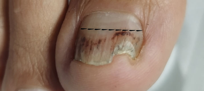 Cleyde Pedicure Medical - Image 12