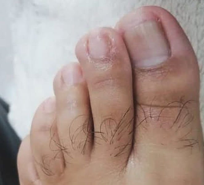 Cleyde Pedicure Medical - Image 3