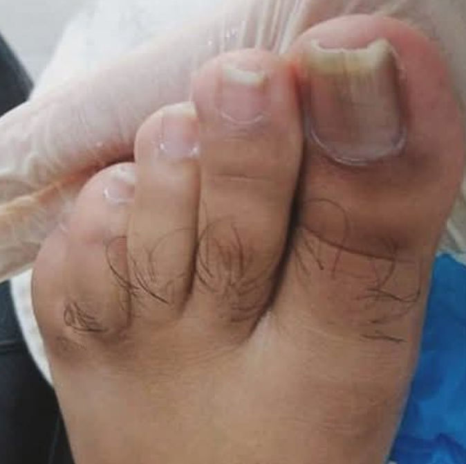 Cleyde Pedicure Medical - Image 5