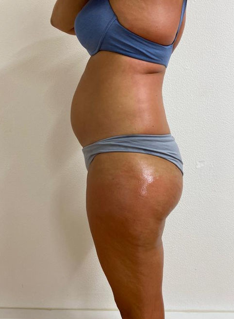 Estética Tatiane Martins - Image 8