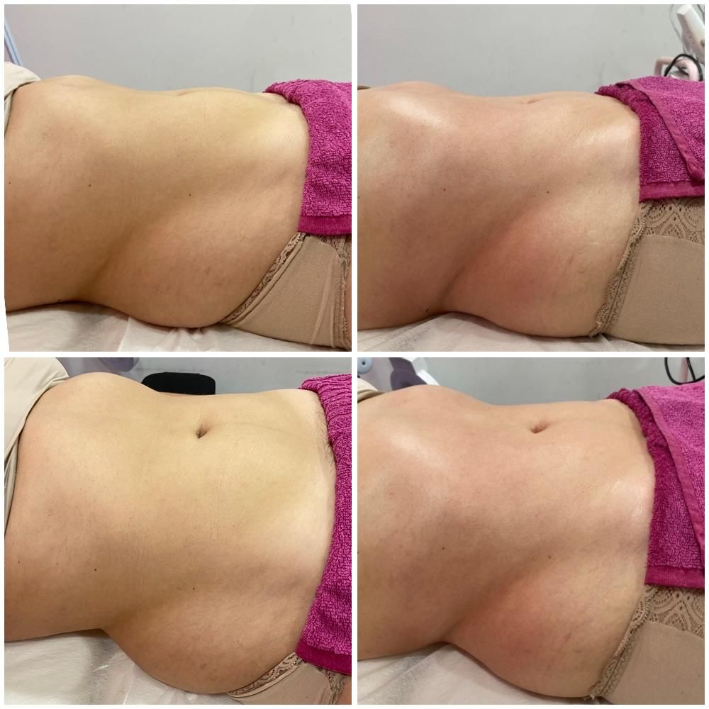 Estética Tatiane Martins - Image 20