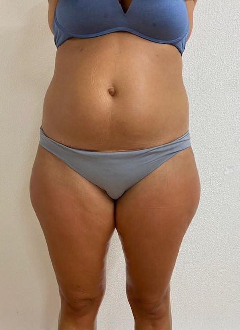 Estética Tatiane Martins - Image 9