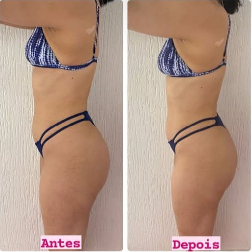 Nutricionista Desportiva Letícia Bricidio - Image 4