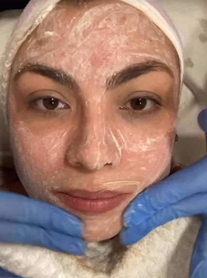 Juliana Rego | Dermatologista - Image 4