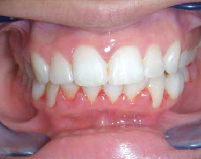 Ilkenia Tavares - Médica Dentista - Image 5