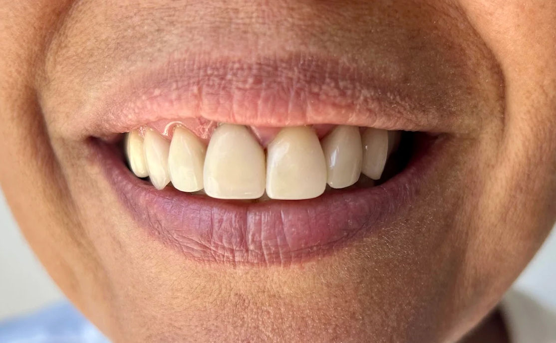 Tágides Medicina Dentária - Image 5