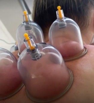 Sther Santana | Massoterapia e Estética - Image 4