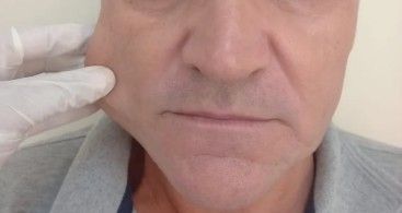 Bio Derme | Estética Avançada e Saúde - Image 5