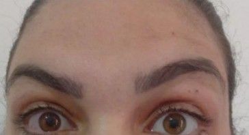 Bio Derme | Estética Avançada e Saúde - Image 4
