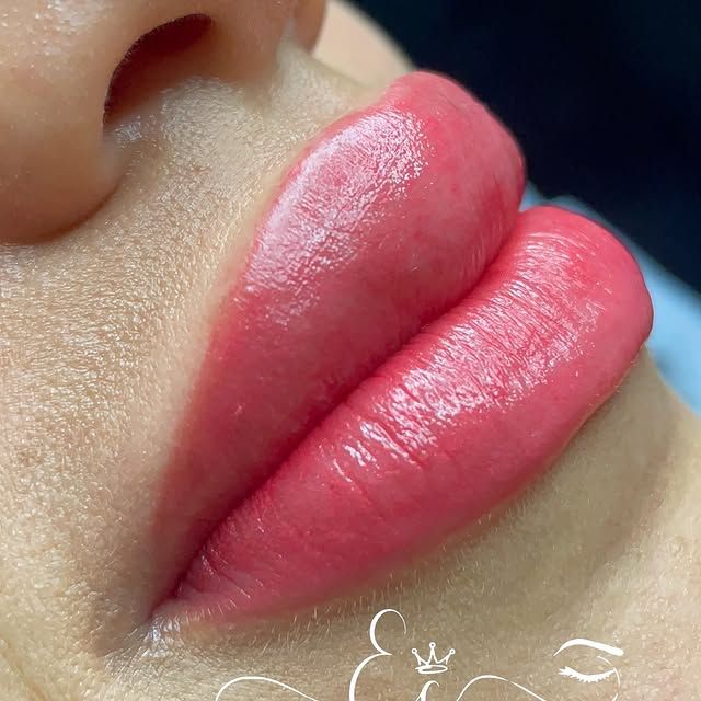 Ane Cerqueira Beauty e Estética Avançada - Image 19