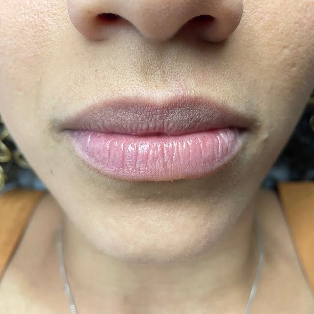 Ane Cerqueira Beauty e Estética Avançada - Image 18
