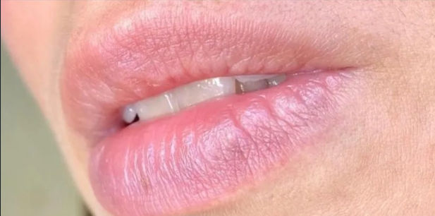 Lilian Mendonça | Estética Avançada - Image 10