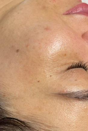 Lilian Mendonça | Estética Avançada - Image 3
