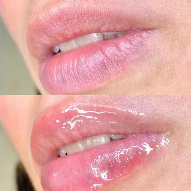 Lilian Mendonça | Estética Avançada - Image 9