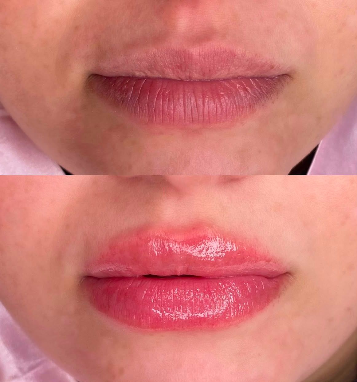 Muse Clínica | Estética Natural - Image 20