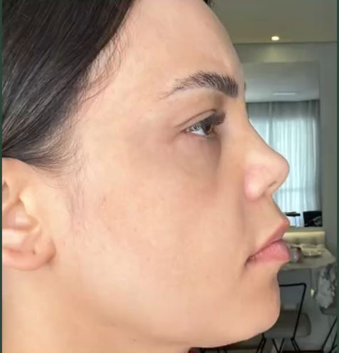 Akácia Depilação & Estética - Image 2