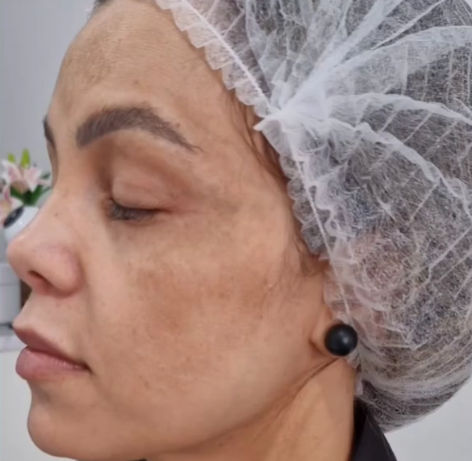 Akácia Depilação & Estética - Image 1