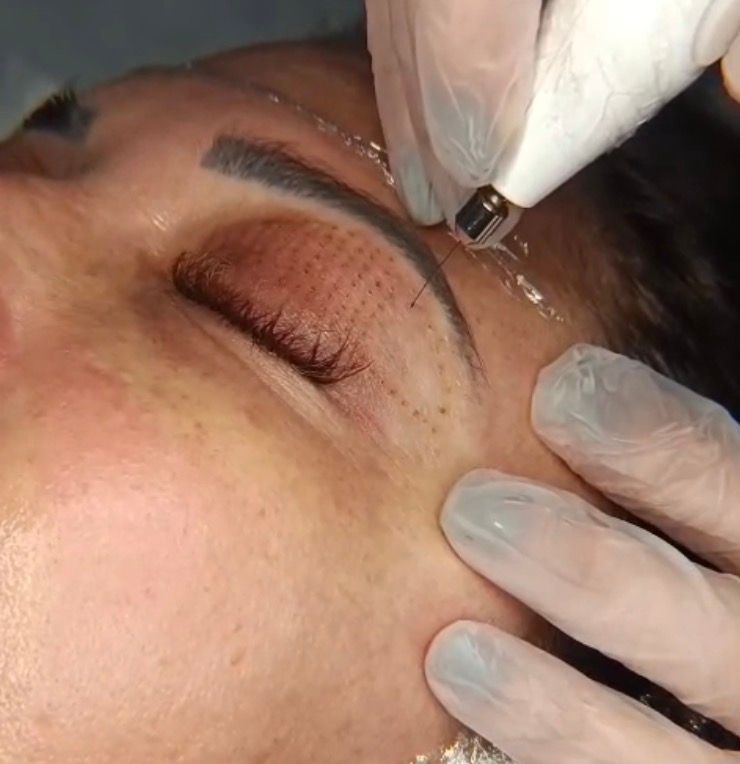 Helenice Mendes - Estética e Saúde - Image 8