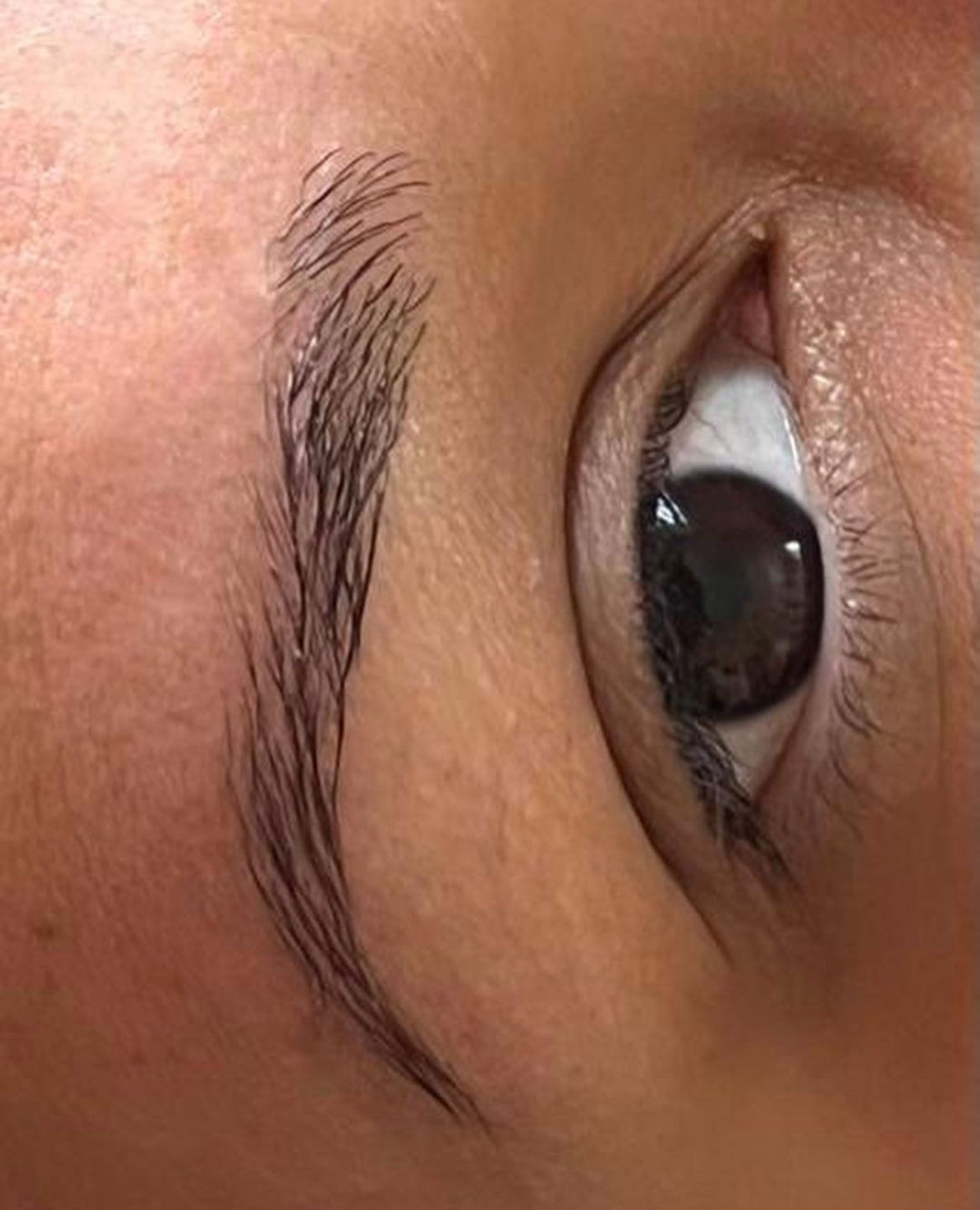 Carla Ferreira | Microblading | Despigmentação | Estética - Image 6