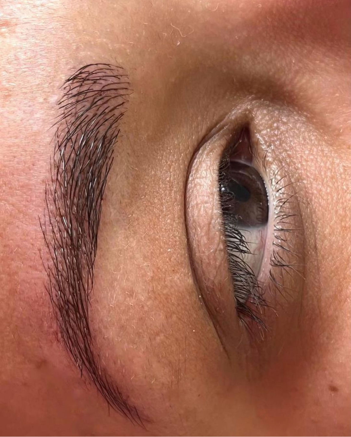 Carla Ferreira | Microblading | Despigmentação | Estética - Image 5
